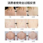 اسپری ضد جوش بدن سیازو رایکو مدل سنتلا آسیتکا حجم 150 میلی لیتر