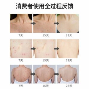 اسپری ضد جوش بدن سیازو رایکو مدل سنتلا آسیتکا حجم 150 میلی لیتر