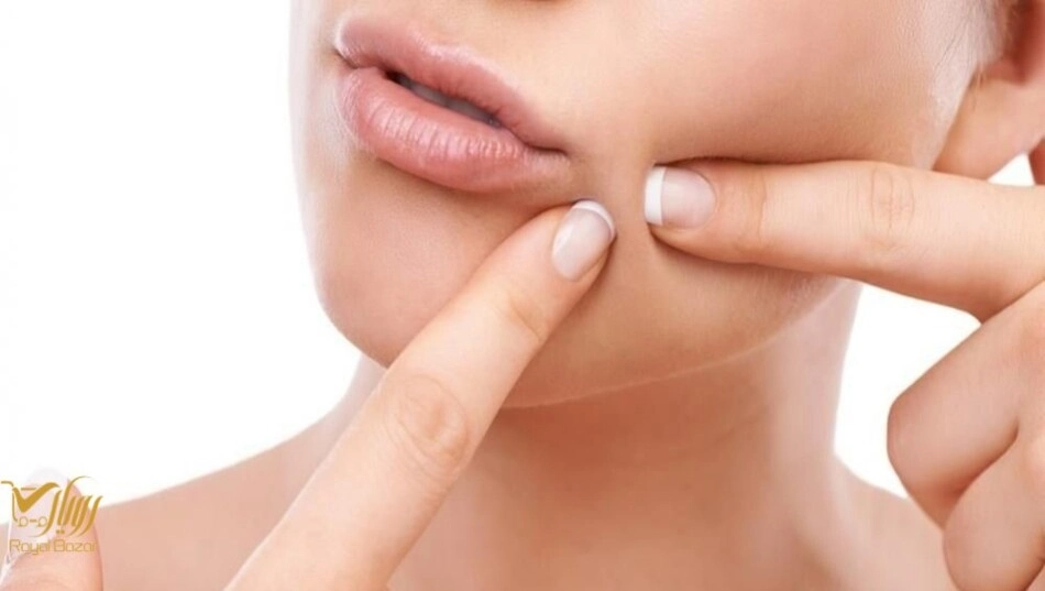 جوش زیرپوستی چیست و چرا ایجاد می‌شود؟
