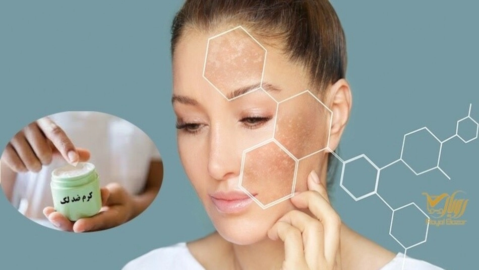 راهنمای خرید کرم ضد لک