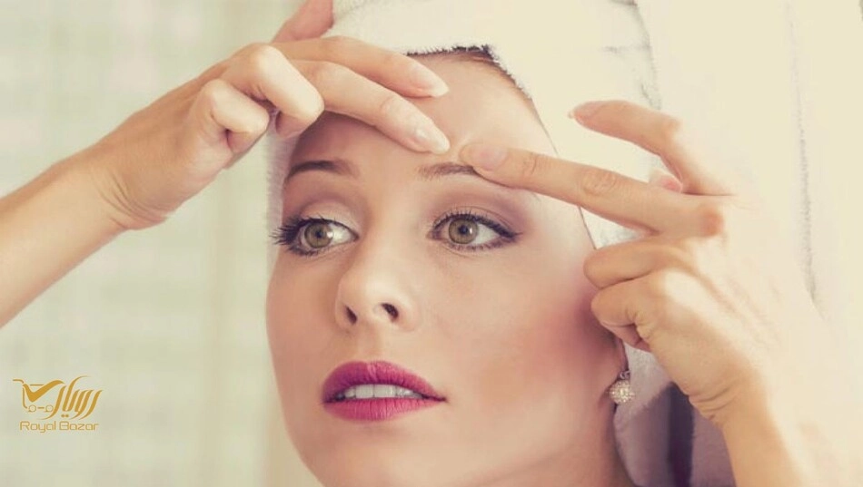 هنگام خرید کرم ضد جوش فوری به چه نکاتی توجه کنیم؟
