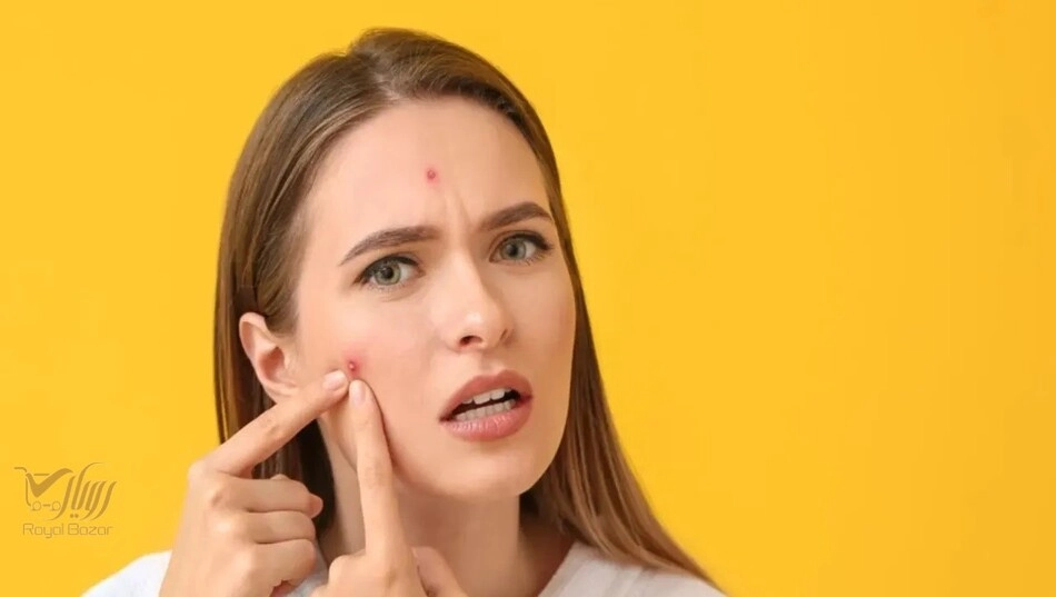 کرم ضد جوش فوری واقعاً مؤثر است؟